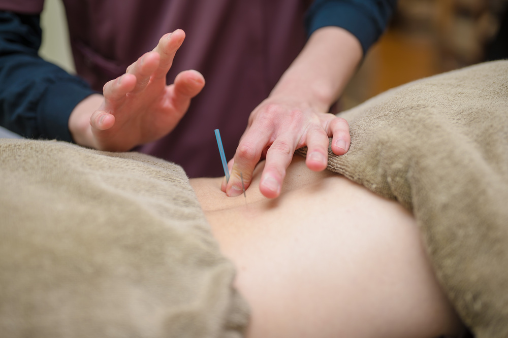 腰痛トリガーポイント鍼施術